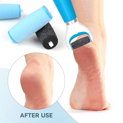 12 Pack Replacement Roller Refill Heads Compatible with Amope Pedi Refills Electronic Foot File (6 Extra Coarse & 6 Regular) - color: 6 Extra Coarse & 6 Regular