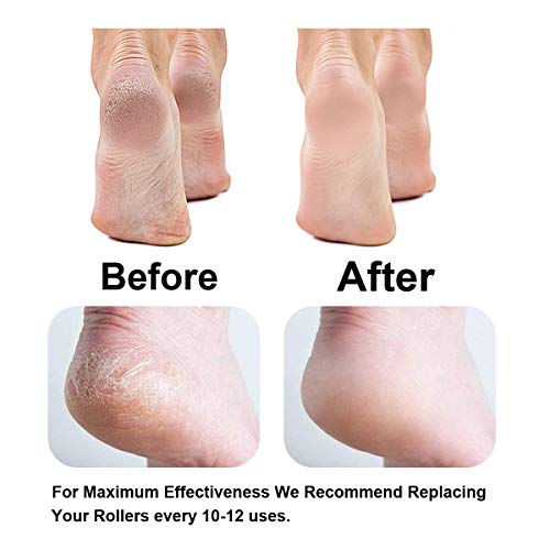 GOMINYUF 6 Pack Replacement Roller for Amope Pedi Foot File, Upgrade Concave Shape Roller for Cracked Heel-Extra Coarse
