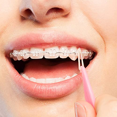 JMU Orthodontic Elastics 3/16 Heavy, 500 Pack Dental Rubber Bands | Orthodontic Rubber Bands for Braces, Intraoral Elastic Bands, Latex Free, Made in USA