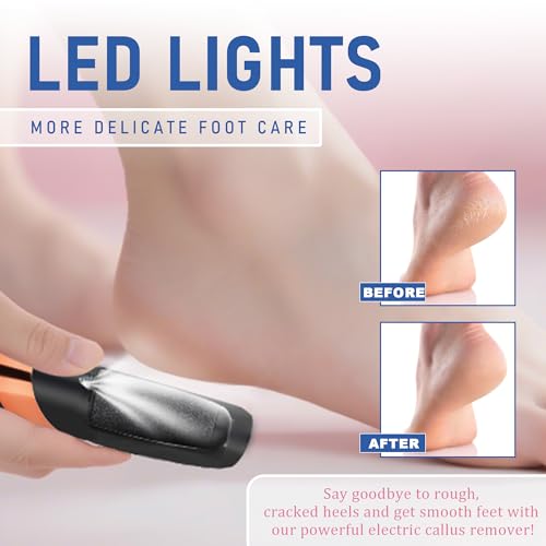 LQT® Electric Foot File – Rechargeable Callus Remover for Hard, Cracked Skin – At-Home Pedicure Kit for Smooth Feet (Men & Women) (Black) - style: Black
