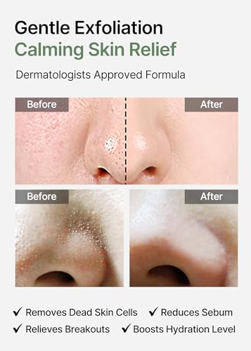 celimax Ji.Woo.Gae Heartleaf BHA Peeling Pad | Pore Care, Exfoliating Double-Side Toner Pads, Facial Peels, Hydrating, Tea Tree, For Acne Prone & Breakouts (60pads) - color: JWG Peeling Pad