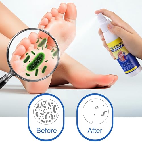 Foot Socks Odor Removal Spray, Helps Extend Shoe Lifespan, 120ml, Natural Foot Spray, Shoe Deodorizer, Easy To Apply, For Women Men Adult Post-Workout Travel Home Athlete Gym School