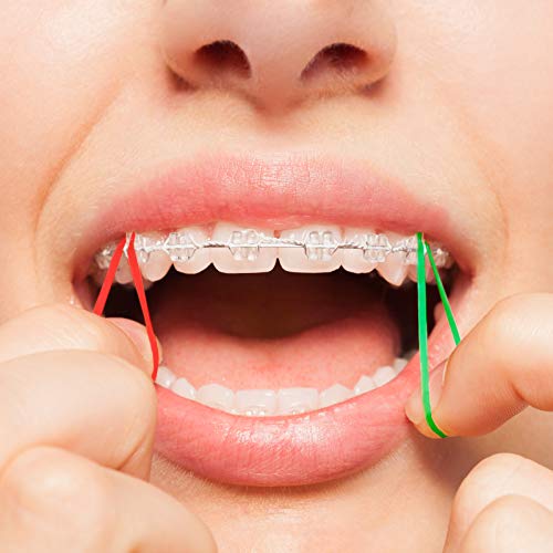JMU Orthodontic Elastics 3/8 Heavy, 100 Pack Dental Rubber Bands | Orthodontic Rubber Bands for Braces, Intraoral Elastic Bands, Latex Free, 6.5 oz, Neon, Made in USA - size: 3/8 Heavy