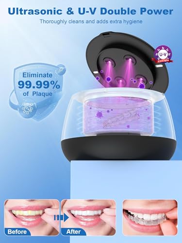 KUNPHY Ultrasonic Retainer Cleaner Machine, 48kHz Dental Cleaning Pod Home | 4 LED Light 48KHz Ultrasound Portable Mouthguard Night Guard Cleaner, IPX7 Waterproof, Quiet 45dB, Overheat Protection, Black - size: 201ML