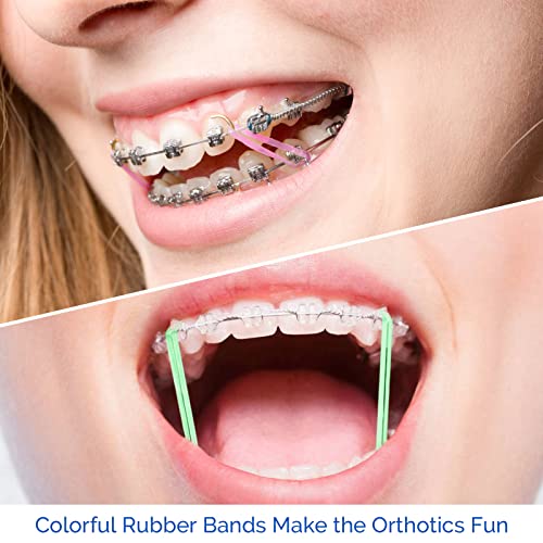 JMU Orthodontic Elastics 3/16 Medium, 100 Pack Dental Rubber Bands | Orthodontic Rubber Bands for Braces, Intraoral Elastic Bands, Latex Free, 4.5 oz, Neon, Made in USA - size: 3/16 Medium