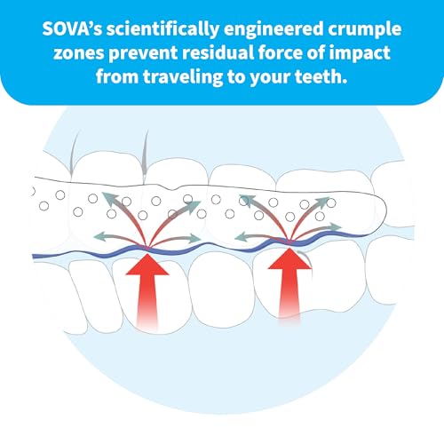 SOVA Aero Night Guard with Case - 1.6mm Thin - Custom-Molded Fit - Protects Against Nighttime Teeth Grinding & Clenching - Odor & Taste Free - Remoldable Up to 20 Times - Non Toxic