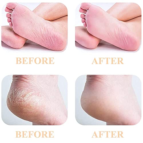 6 Pcs Pedicures Replacement Heads for Flawless Pedi Electric Tool Foot File | Pedi Replacement Roller Head Fit For Finishing Touch Flawless Pedi (3 Coarse & 3 Fine)