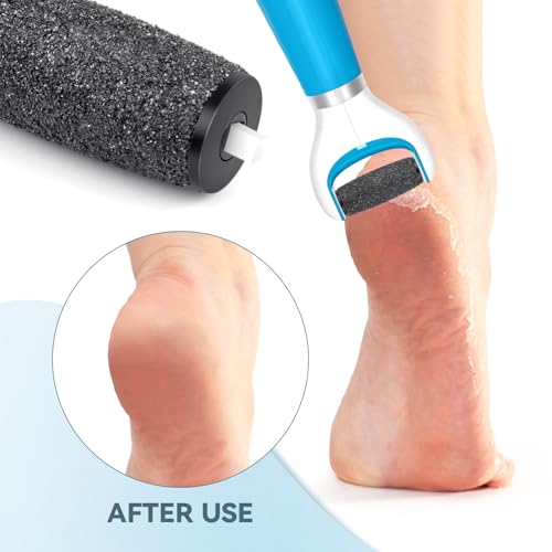 12 Pack Replacement Roller Refill Heads Compatible with Amope Pedi Refills Electronic Foot File (12 Extra Coarse) - color: 12 Extra Coarse