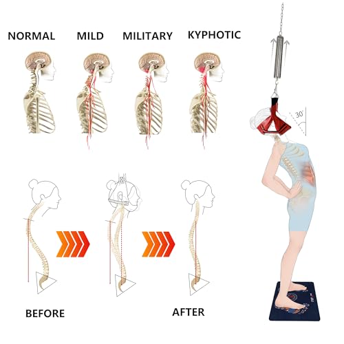 LittleMum Cervical Traction Apparatus, Spinal Decompression Device, Neck Stretcher (Dark RED-Velvet Head Halter)