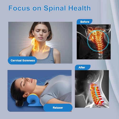 Neck Stretcher with Magnetic Therapy Acupressure for Pain Relief, Neck and Shoulder Relaxer, Chiropractic Pillow, Restore Neck Curve (Blue) - color: Blue
