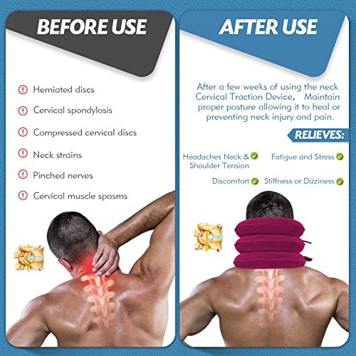 Jaximy Neck Stretcher, Cervical Traction Device, Neck Traction Device, Neck Pain Relief, Adjustable Inflatable Neck Brace & Neck Stretcher, Neck Decompression Home Use (Red) - color: Red