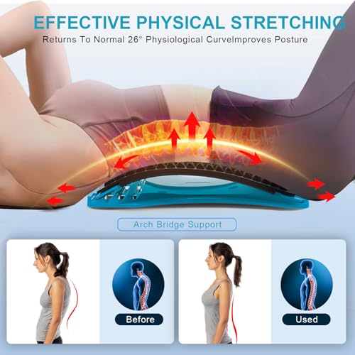 MINOLL Back Stretcher for Lower Back Pain Relief, Multiple Level Adjustable Arch Lumbar Back Cracker Board, Back Cracking Device, Back Massager for Scoliosis, Spine Decompression Support - color: Dark Blue