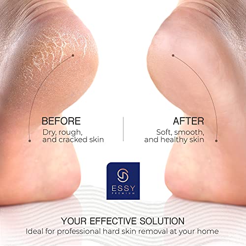 Essy Electric Foot File Hard Skin Remover with 5 Replacement Rollers Foot File Electric Pedicure Sets Cutters Accessories for Dry Dead Hard Skin Feet Callus Remover for Feet Care Exfoliator (Navy) - color: Navy
