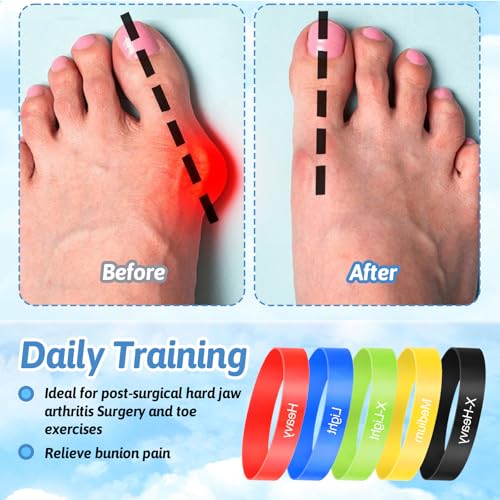 5Pcs Toe Stretcher Bands for Bunions, Toe Bands Resistance for Women and Men with Storage Bag(Yellow/Green/Red/Blue/Black)
