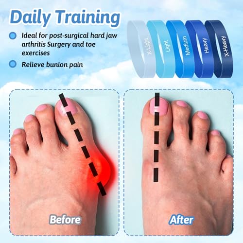 Toe Stretch Bands for Bunions, Women and Men, 5Pcs, Blue | Toe Resistance Bands, Storage Bag Included