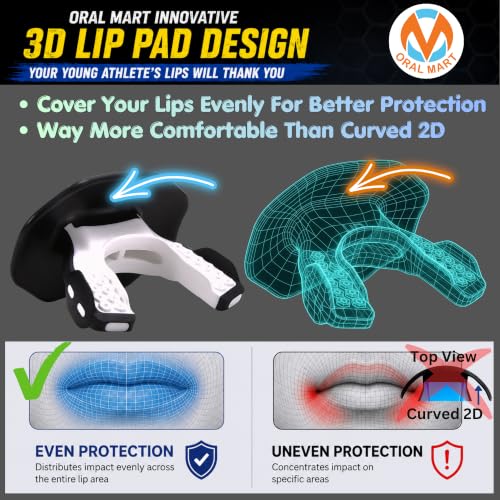 Oral Mart Flag Football Mouth Guard with 3D LipFit Design for Kids - Youth Football Mouthguard (No Boil) Cool Instant Fit Lip Guard Mouthpiece for Braces (Detachable Helmet Strap Included) - color: Ice & Fire