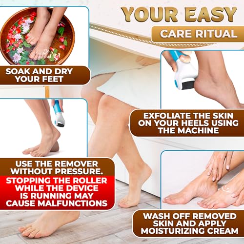 Battery Operated Foot Callus Remover for Dead Skin, Exfoliating Tool | Electric Foot Grinder for Cracked Heels & Calluses; Replaceable Roller Head; Pedicure Tools for Feet, Smooth Skin at Home - color: Ocean Blue Callus Remover