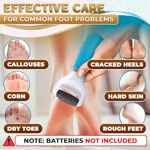 Battery Operated Foot Callus Remover for Dead Skin, Exfoliating Tool | Electric Foot Grinder for Cracked Heels & Calluses; Replaceable Roller Head; Pedicure Tools for Feet, Smooth Skin at Home - color: Ocean Blue Callus Remover