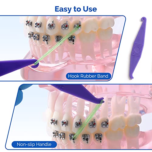 JMU Orthodontic Elastics 3/16 Medium, 100 Pack Dental Rubber Bands | Orthodontic Rubber Bands for Braces, Intraoral Elastic Bands, Latex Free, 4.5 oz, Neon, Made in USA - size: 3/16 Medium