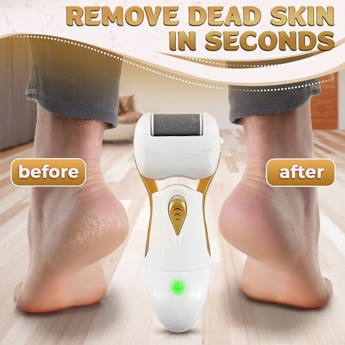 Electric Callus Remover for Feet – Electric Foot Filer with 3 Replacement Rollers & 360° Rotating Head – Hard Skin Remover for Feet with Ergonomic Handle for Easy Grip & Control in Home Pedicure - color: Gold Callus Remover