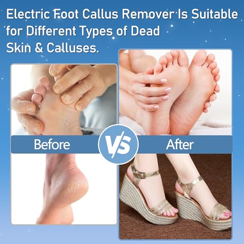 Callus Remover for Feet, Electric Foot Callus Remover Waterproof with 3 Rollers 2 Speed Battery Display,17 in1 Rechargeable Foot File Pedicure Kits for Dead Hard Cracked Dry Skin - style: Black