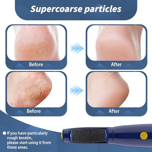 8 pcs Replacement Roller Compatible with Dr. Scholl's Callus Remover Electronic Foot File-Extra Coarse,Perfect for Travel,for Women&Men
