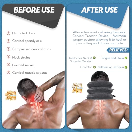 Neck Stretcher, Cervical Traction Device, Neck Traction Device, Neck Pain Relief, Adjustable Inflatable Neck Brace & Neck Stretcher, Neck Decompression Home Use (Dark Gray) - color: Dark Gray