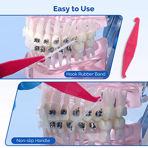 JMU Orthodontic Elastics 3/16 Heavy, 500 Pack Dental Rubber Bands | Orthodontic Rubber Bands for Braces, Intraoral Elastic Bands, Latex Free, Made in USA