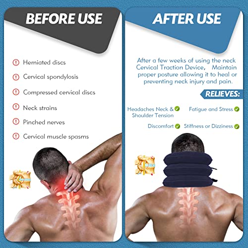 Jaximy Neck Stretcher, Cervical Traction Device, Neck Traction Device, Neck Pain Relief, Adjustable Inflatable Neck Brace & Neck Stretcher Cervical Traction, Neck Decompression Home Use (Blue) - color: Blue