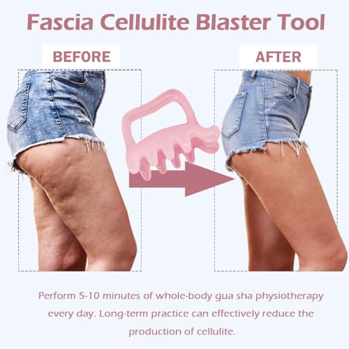 Lymphatic Massager for Cellulite Remover Body Sculpting - Handheld Cellulite Massage Tool for Body Bloat Blood Circulation Lymphatic Drainage Fascia Massage - size: Fascia Massager-pink