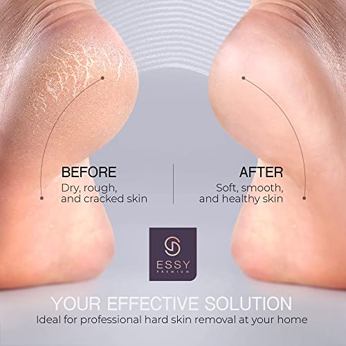 Essy Electric Foot File Hard Skin Remover with 5 Replacement Rollers Foot File Electric Pedicure Sets Cutters Accessories for Dry Dead Hard Skin Feet Callus Remover for Feet Care Exfoliator (Purple) - color: Purple