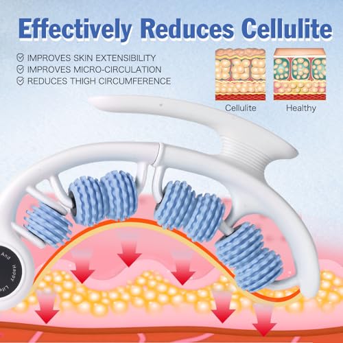 Cellulite Massage Tool Lymphatic Drainage Massager for Thighs & Legs & Buttocks, Anti Cellulite Roller with Detachable Handles Fascia Massage Tool for Contoured & Smoother Skin, White-Blue - color: White