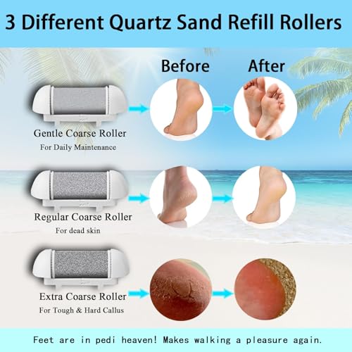 Callus Remover for Feet, 13-in-1 Professional Pedicure Tools Foot Care Kit, Foot Scrubber Electric Feet File Pedi for Hard Cracked Dry Dead Skin, 3 Rollers, 2 Speed, Battery Display (White&Grey) - style: White&Grey