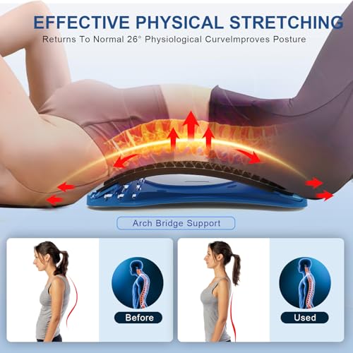 MINOLL Back Stretcher for Lower Back Pain Relief, Multiple Level Adjustable Arch Lumbar Back Cracker Board, Back Cracking Device, Back Massager for Scoliosis, Spine Decompression Support - color: Blue