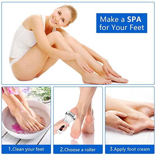 Electric Foot Callus Remover Kit, Elmchee Rechargeable Callous removers 3 Grinding Heads Waterproof Foot Scrubber File, Professional Pedicure Tools kit Feet Care for Dead, Cracked Dry Skin - style: White