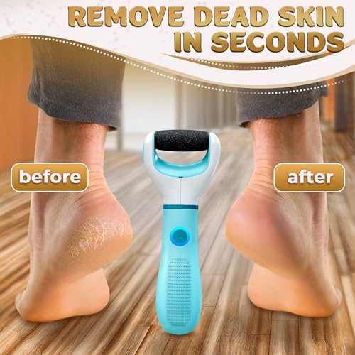 Electric Foot Callus Remover for Feet, 3 Speeds Up to 2800 RPM | Foot Sander & Hard Skin Remover, Replaceable Roller, Dust Cap, Pedicure Tools for Feet Care, Anti-Slip Ergonomic Grip - color: Blue and White Callus Remover