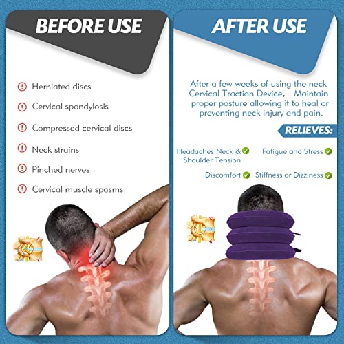 Jaximy Neck Stretcher for Neck Pain Relief, Cervical Traction Device, Neck Traction Device, Adjustable Inflatable Neck Brace & Cervical Neck Traction Device Home Use Decompression(Purple) - color: Purple