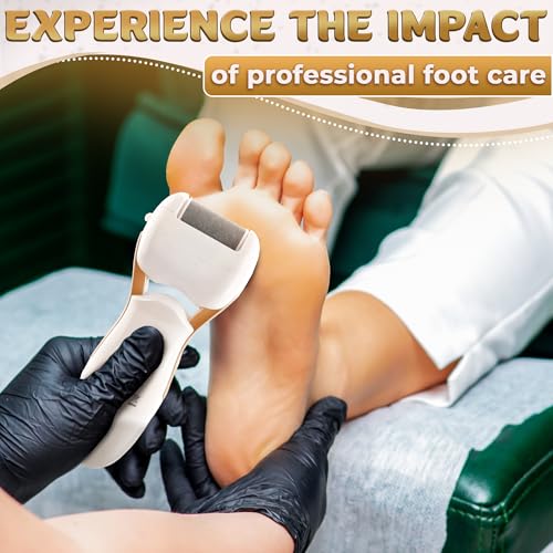 Electric Callus Remover for Feet – Electric Foot Filer with 3 Replacement Rollers & 360° Rotating Head – Hard Skin Remover for Feet with Ergonomic Handle for Easy Grip & Control in Home Pedicure - color: Gold Callus Remover