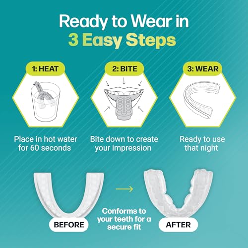 Dental Guard – Custom-Fit Mouth Guard for Grinding Teeth at Night – Slim Night Mouth Guards for Sleeping with Jaw Comfort – Easy & Secure Fit for Nighttime Enamel Protection (Clear, 1 Count)