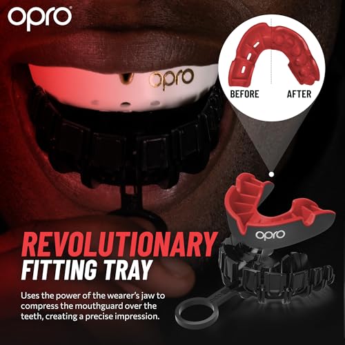 OPRO Silver Level Moldable Mouth Guard Essential Fit (Pink/Green) Kids Youth Boxing Mouthguard for MMA & Impact Sports, Easy Self-Fit Mouth Guard for Sports, Football & Hockey - Includes Case - color: Pink/Green, size: Youth (Under 10)