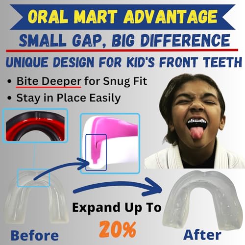 Oral Mart Youth Sports Mouth Guard for Kids (USA Flag, Fangs, 20+ Colors to Choose from) Mouthguard for Football, MMA, Karate, Boxing, Rugby, BJJ, Flag Football – /w Case (Youth, Strapless) - color: Clear/Semi Clear
