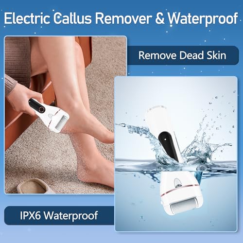 Callus Remover for Feet, Electric Foot Callus Remover Waterproof with 3 Rollers 2 Speed Battery Display,17 in1 Rechargeable Foot File Pedicure Kits for Dead Hard Cracked Dry Skin（White - style: White