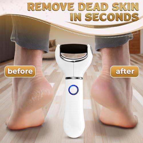 Electric Foot File Callus Remover for Feet, 3-Speed, 2 Rollers | Foot Scrubber Electric, 1800/2200/2800 RPM, 80 & 60 Grit Rollers & Cleaning Brush, LED Indicator for Cracked Heels & Dry Skin - color: White Callus Remover