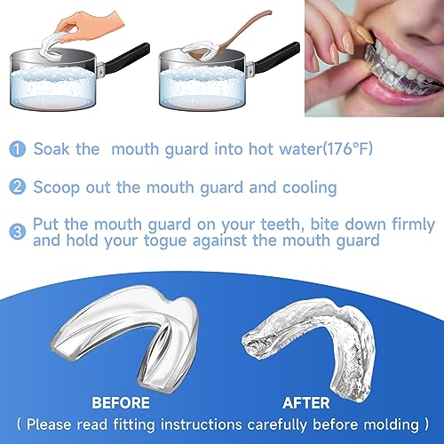 Blue Mouth Guards for Kids,4 Pack Small Szie, 1 Storage Case Included