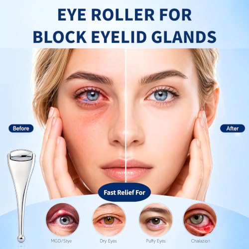 Metal Eye Roller for Dry Eye Relief & Puffy Eyes- Eyelid Roller for Chalazion,Stye,MGD Relief,Improves Meibum Flow and Unclogs Oil Glands,Gentle Meibomian Gland Expression for Blocked Eyelid Glands